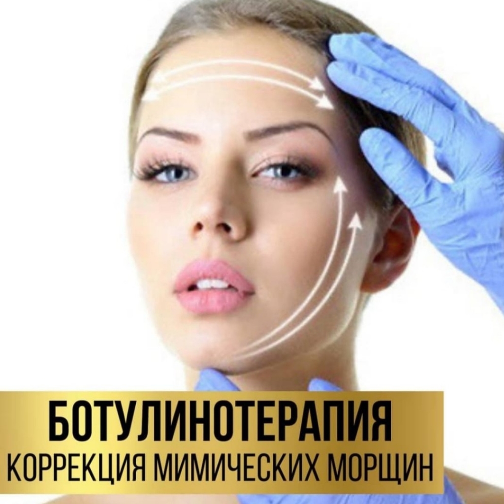Коррекция мимических морщин