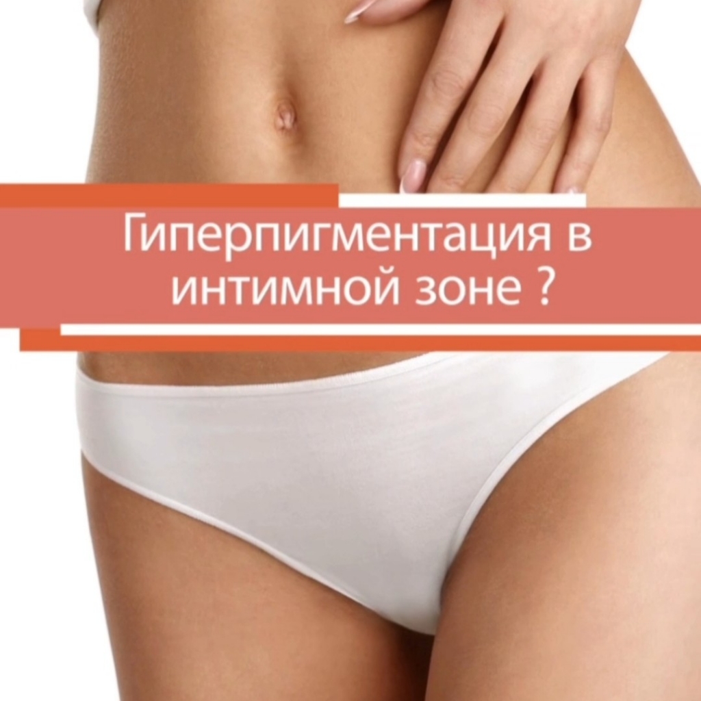 Коррекция гиперпигментации интимной области