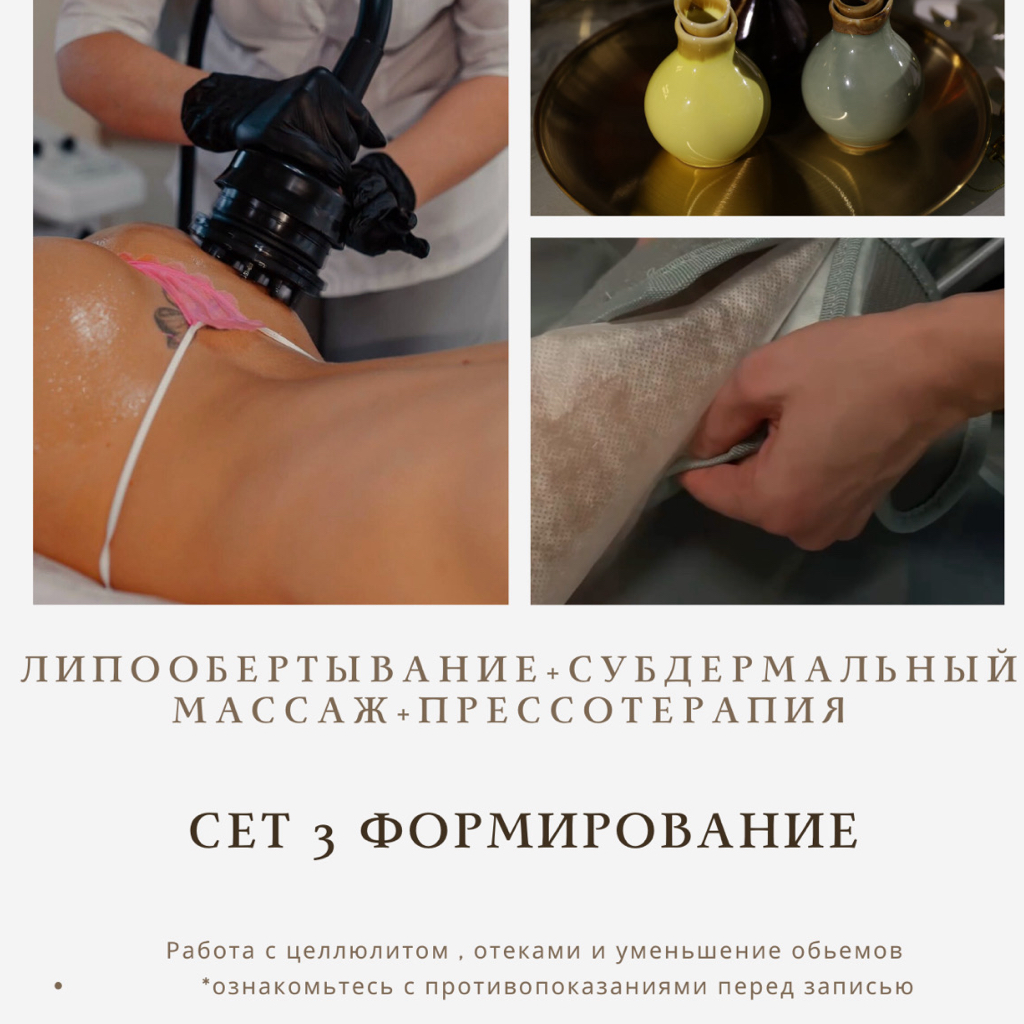 Сет 3 - Формирование