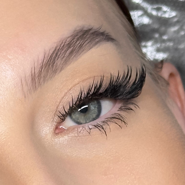 Нижнее наращивание