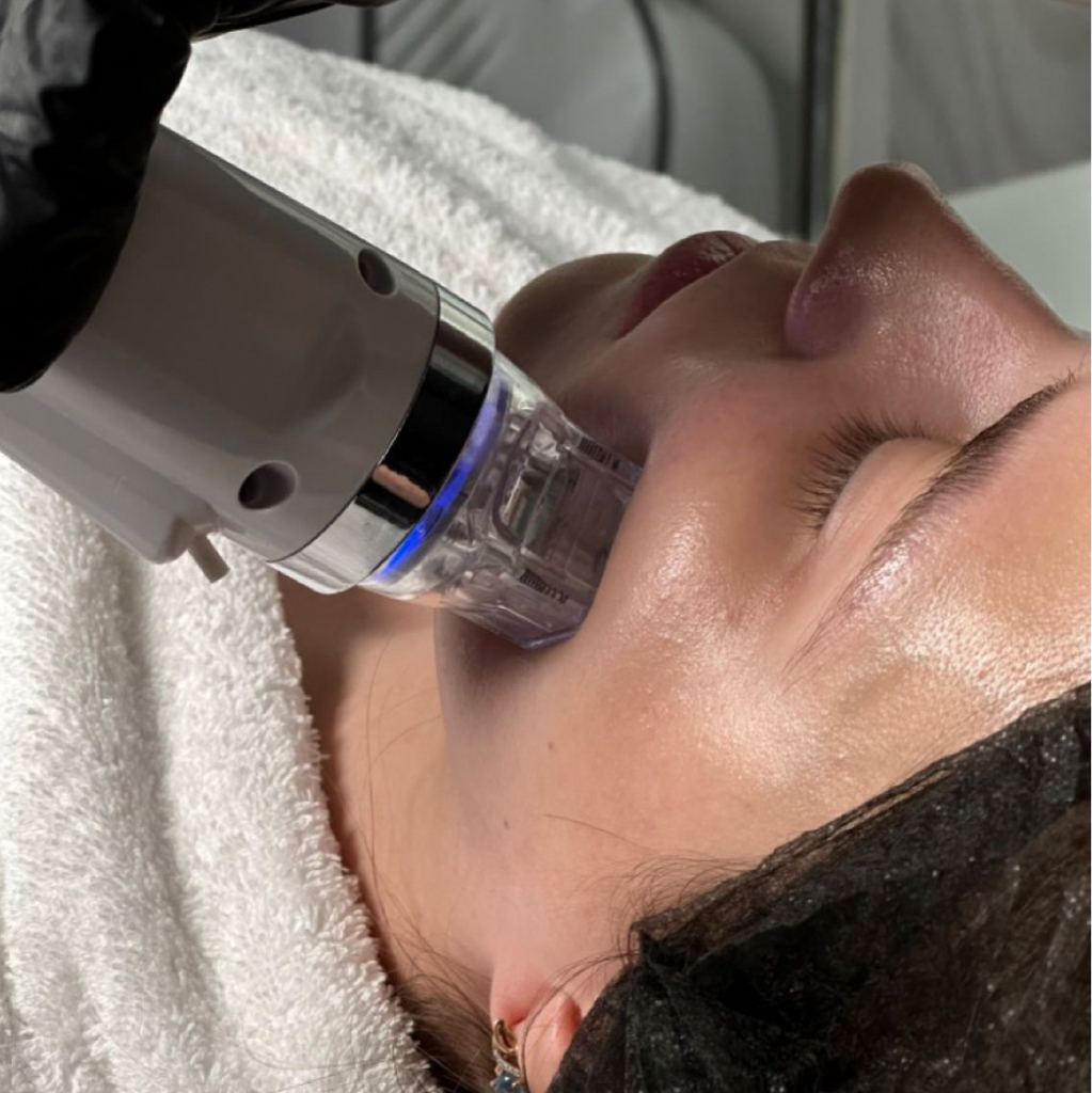 Микроигольчатый RF-лифтинг