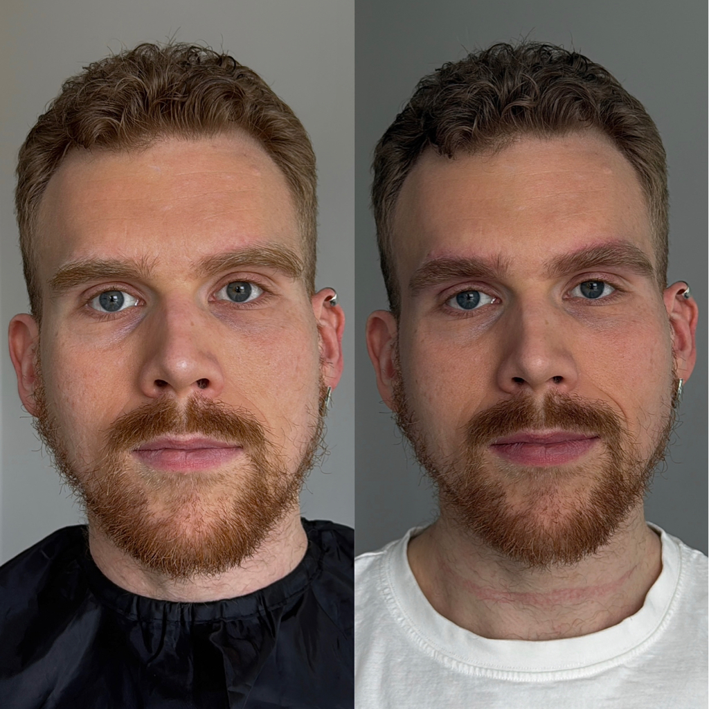 КОРРЕКЦИЯ/ПРОРЕЖИВАНИЕ С УХОДОМ