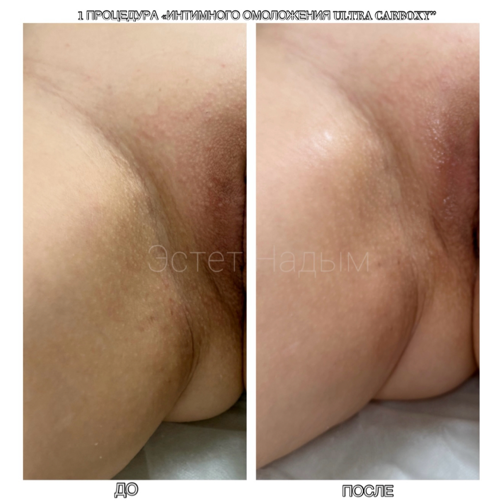 Интимдік Донецк облысы Интимдік Донецк облысы