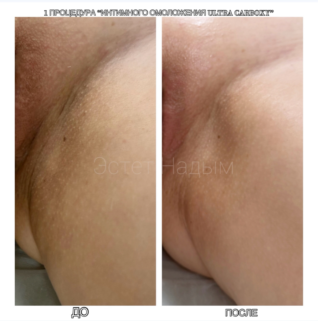 Интимдік демалыс Добропилля форумы