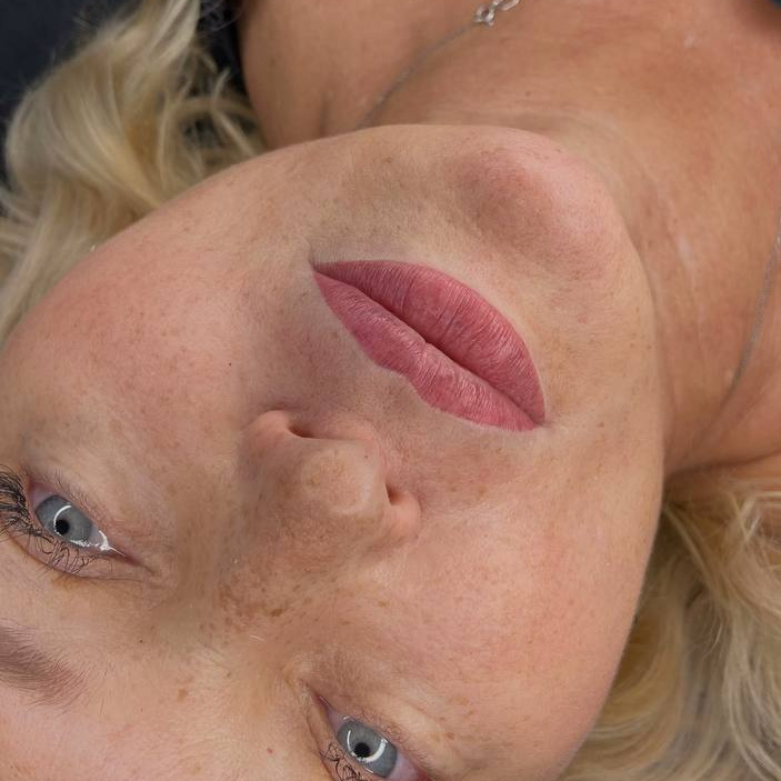 Коррекция любой зоны (от 1 до 3 месяцев)