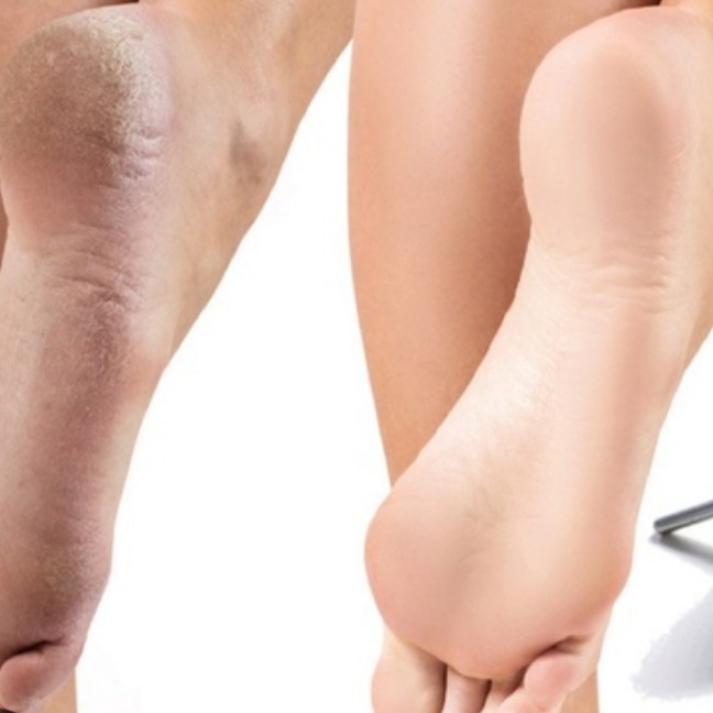 Педикюр СТОПА (без обработки пальчиков)