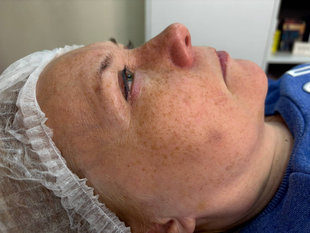 Биогель Ред 3мл  мл лицо+ вокруг глаз