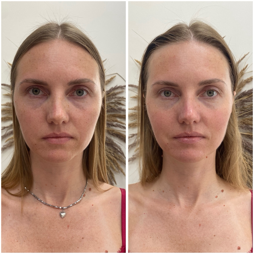 КОРРЕКТИРУЮЩИЙ МАССАЖ лица и тела с помощью мануальной, вакуумной и аппаратной методики