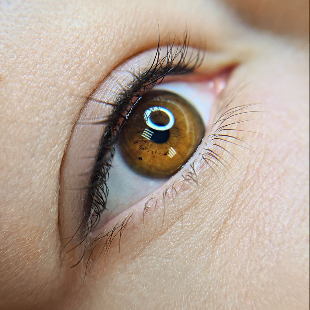 Межресничка