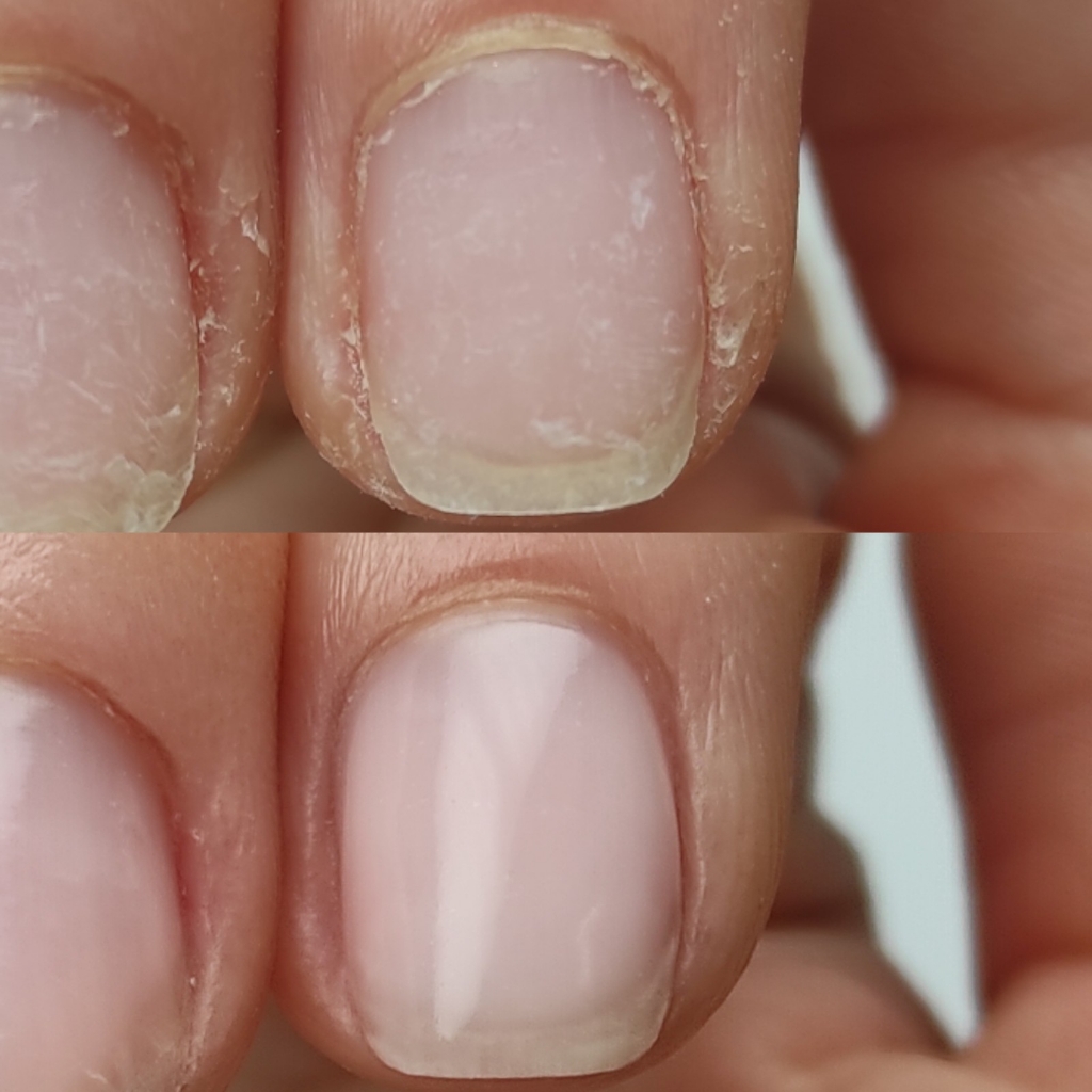 Кератиновое ламинирование ногтей "Жидкие ногти" LCN Германия