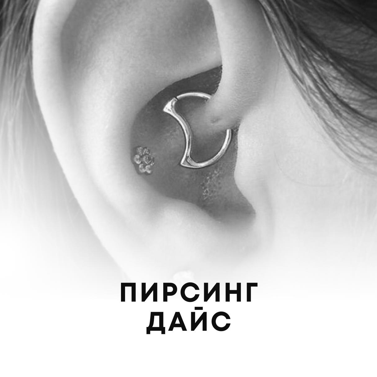 Прокол Дайс