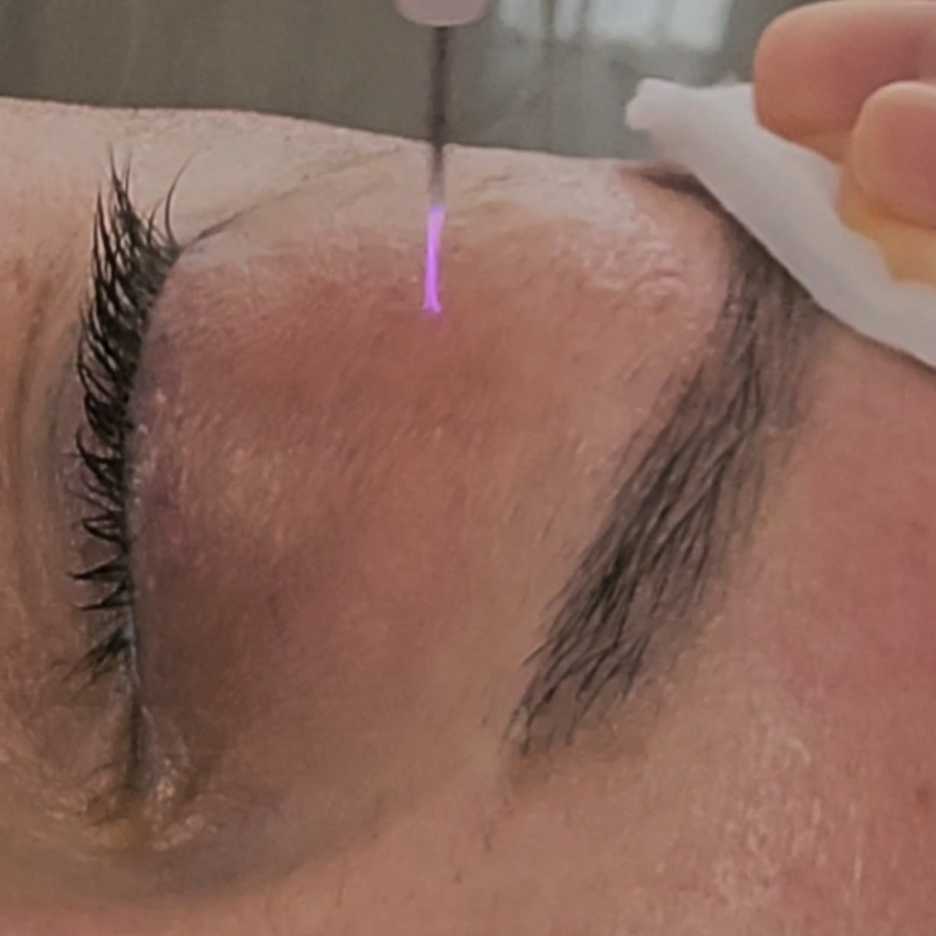 Холодная плазма