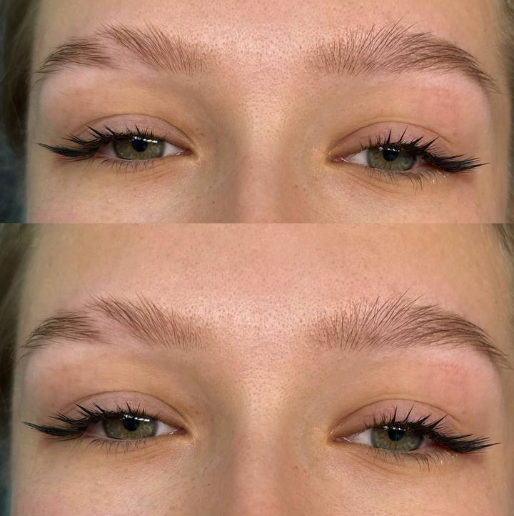 Электра эффект