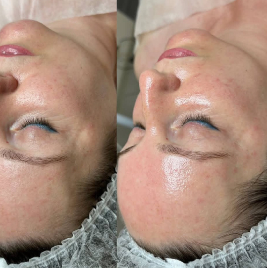 ВОЗРОЖДЕНИЕ