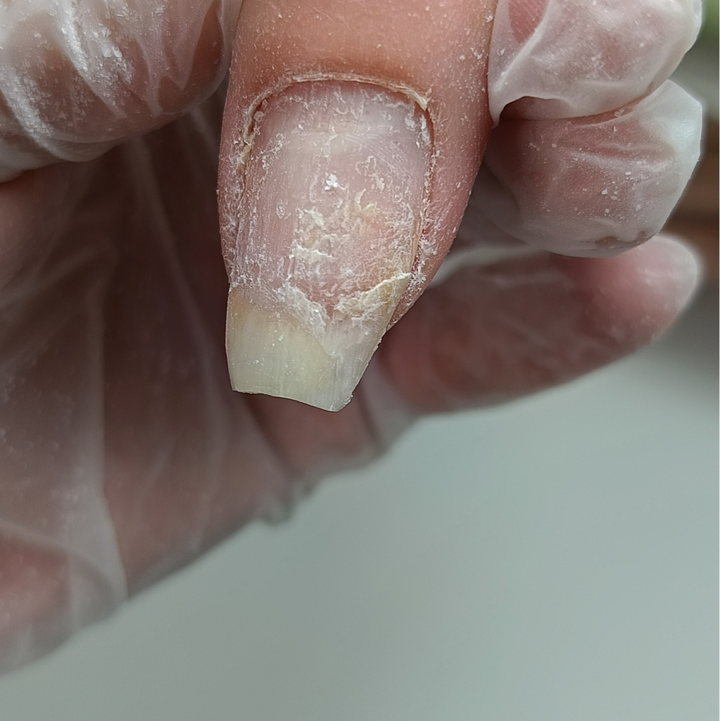 Ремонт ногтя