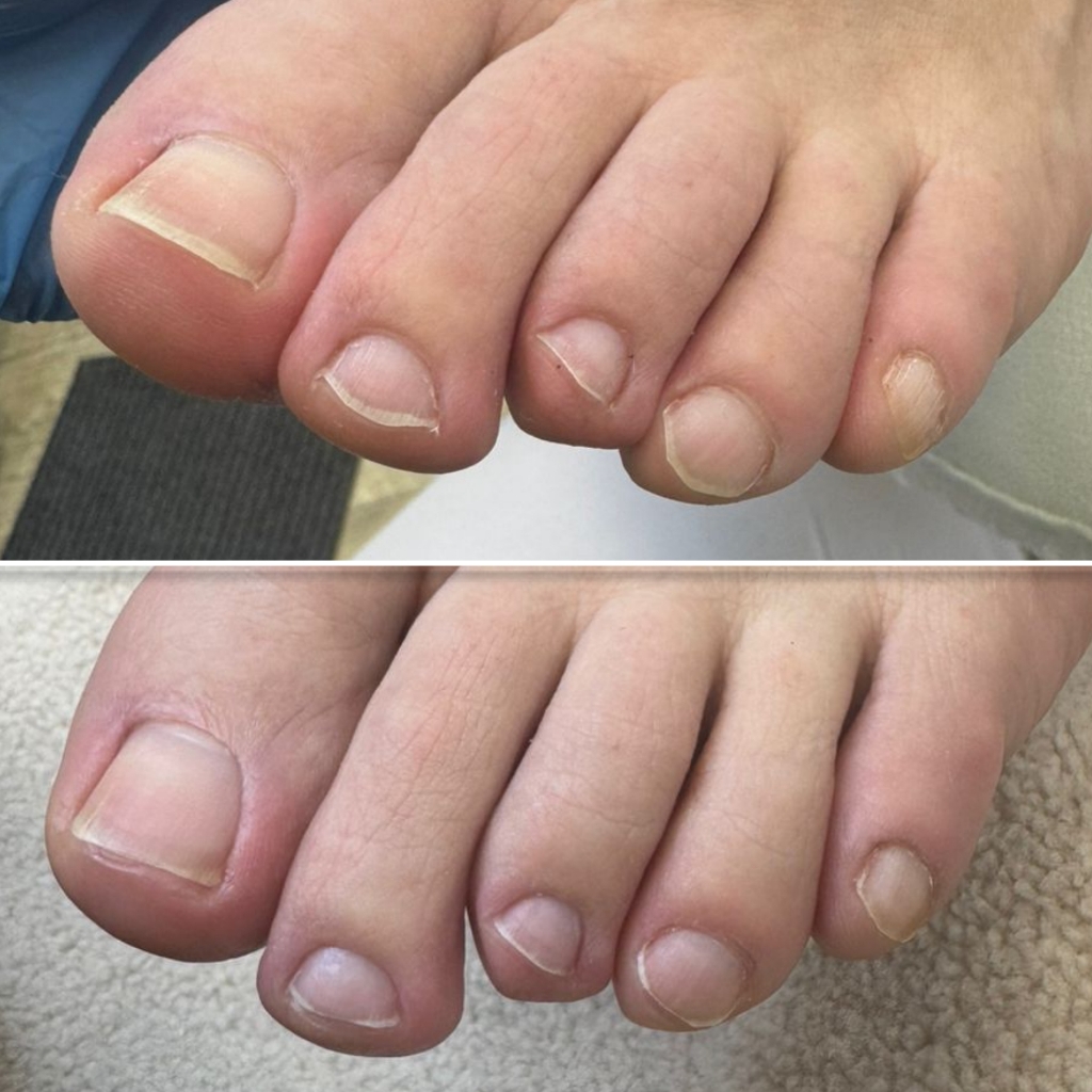 Частичный педикюр (пальчики) ЭСТЕТИКА