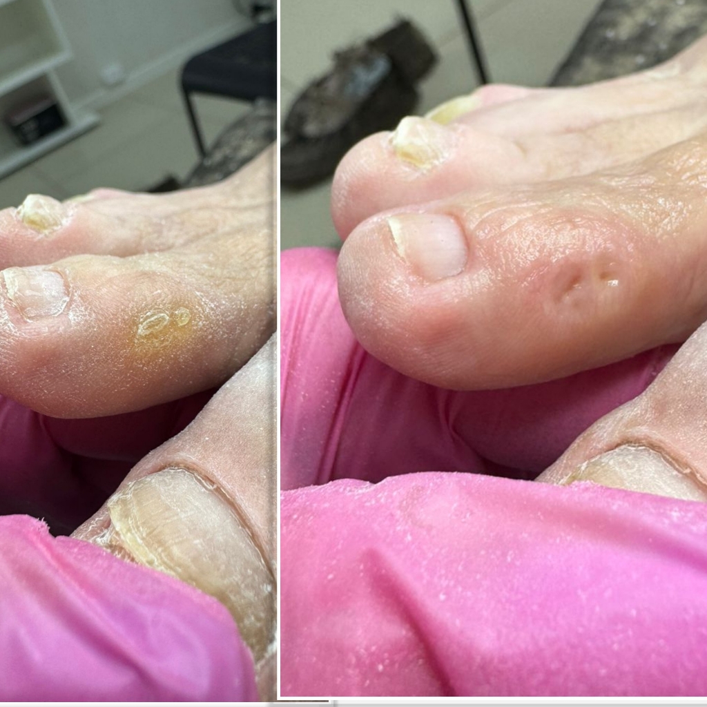 Обработка одной проблемой зоны