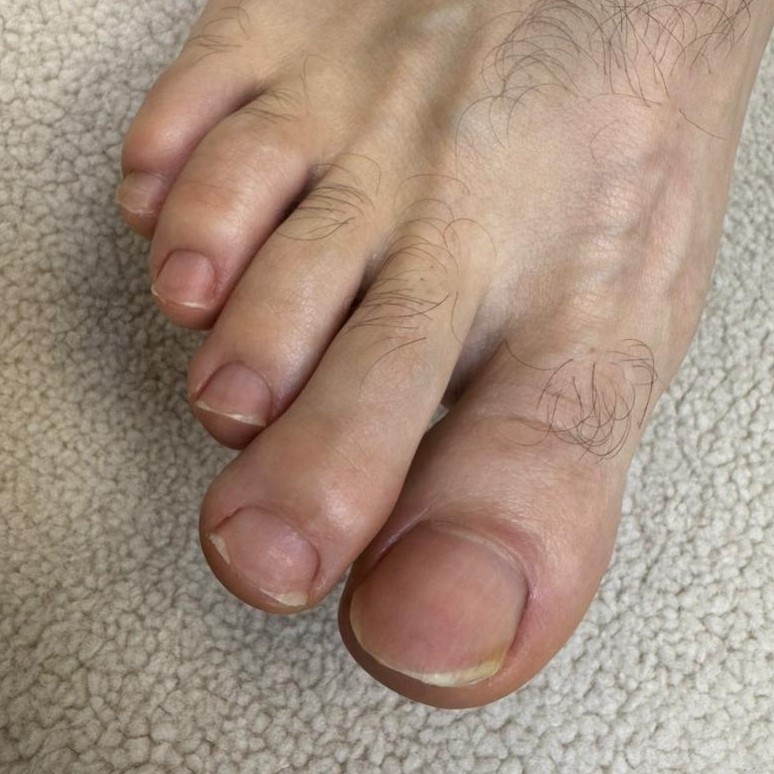 Мужской педикюр