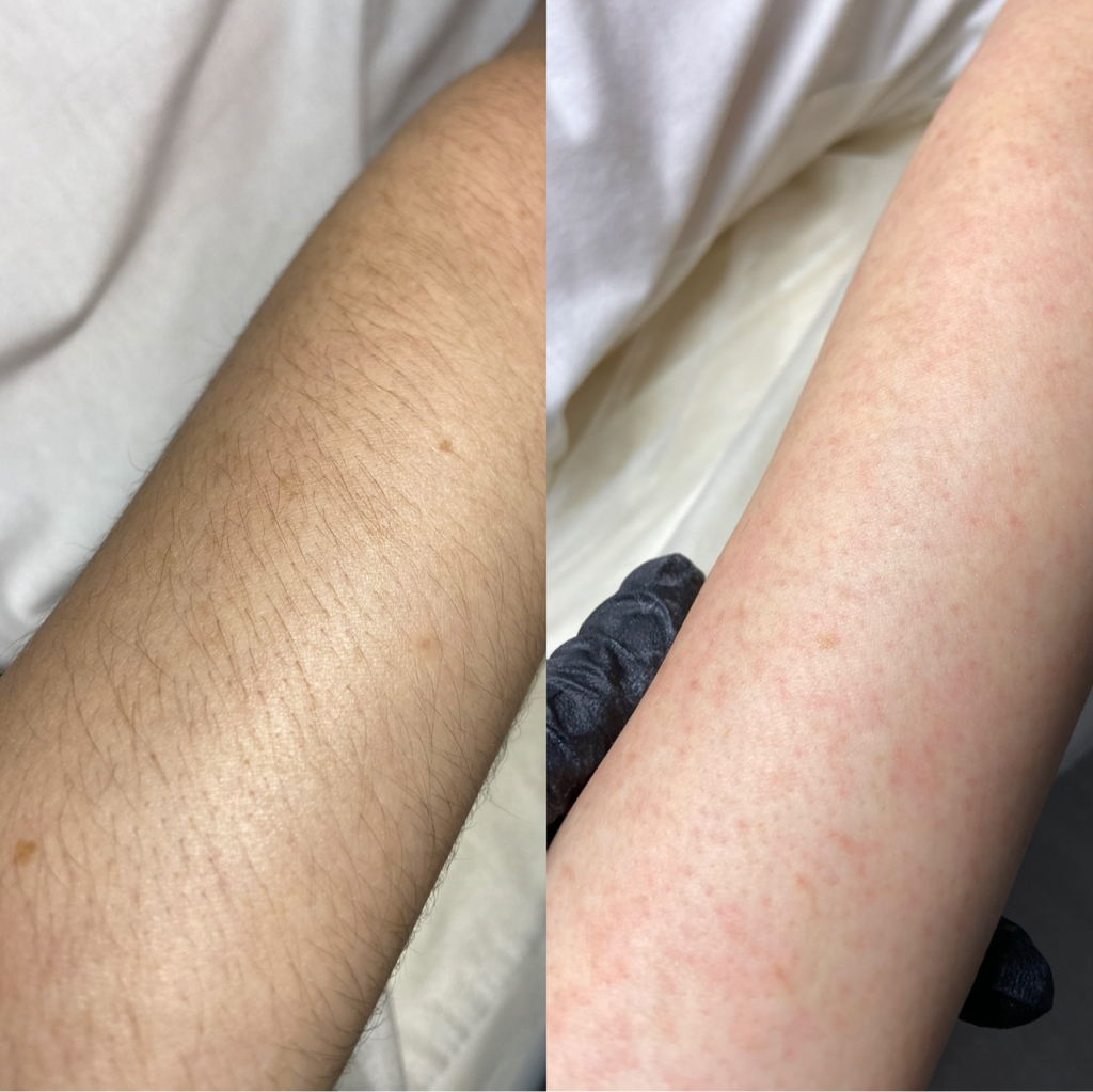 Руки полностью