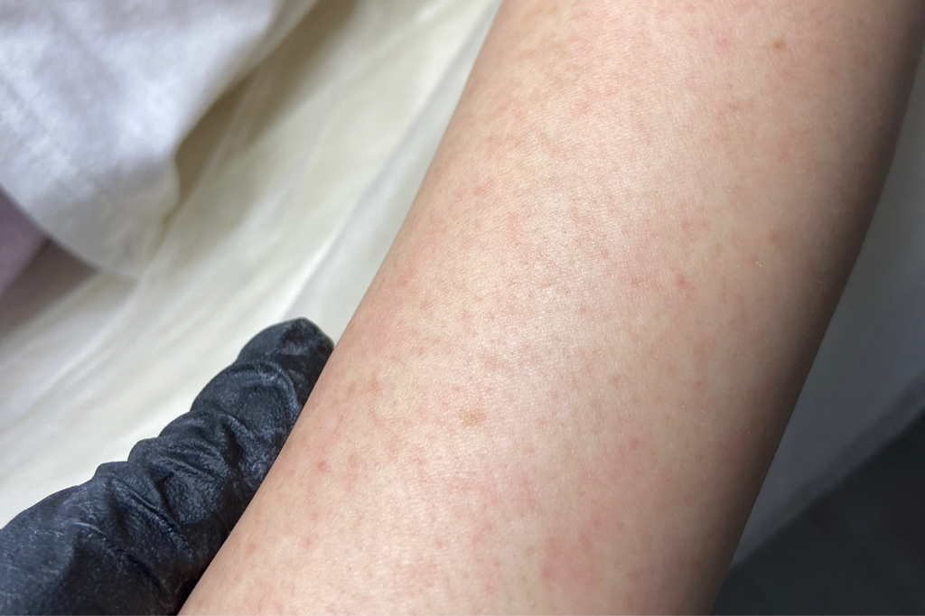 Руки до локтя