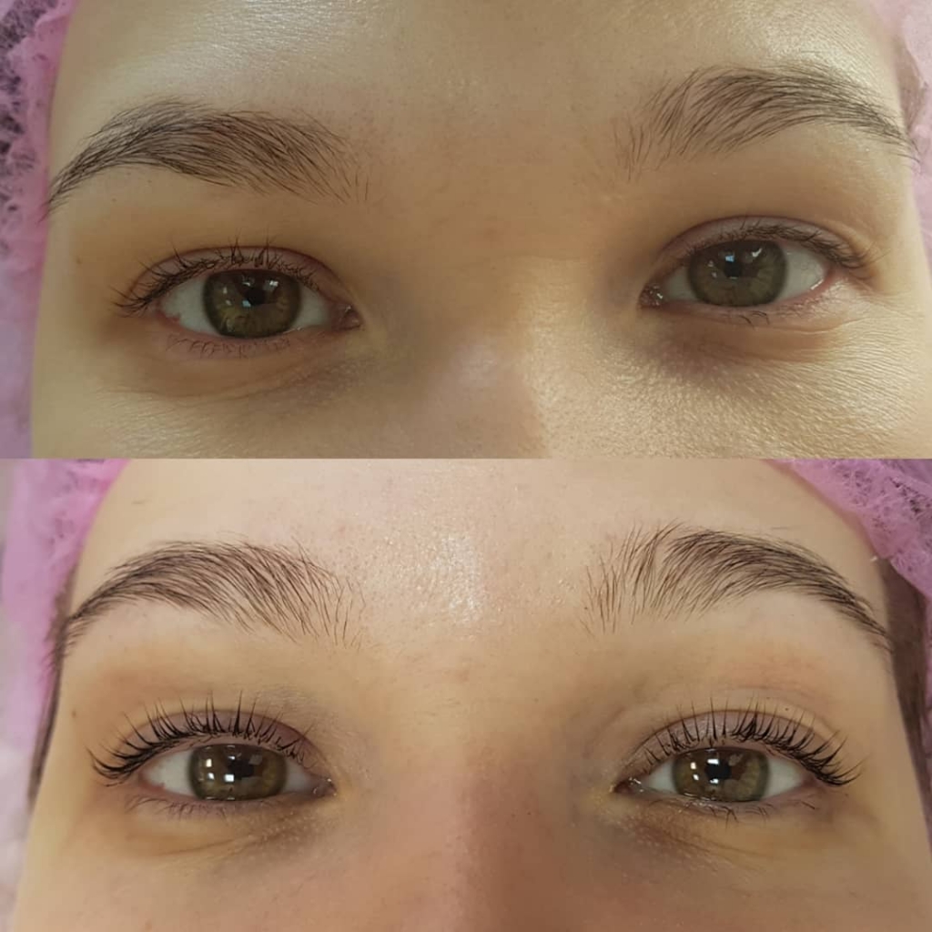 Стрейчинг ресниц