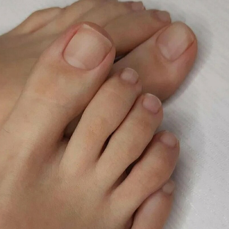 Педикюр гигиенический