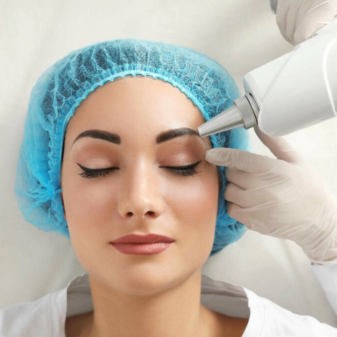 Лазерное удаление перманентного макияжа бровей