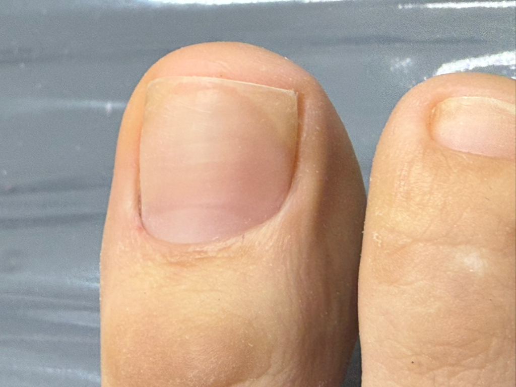 Снятие от другой студии +педикюр обработка пальцев и пяточек без покрытия