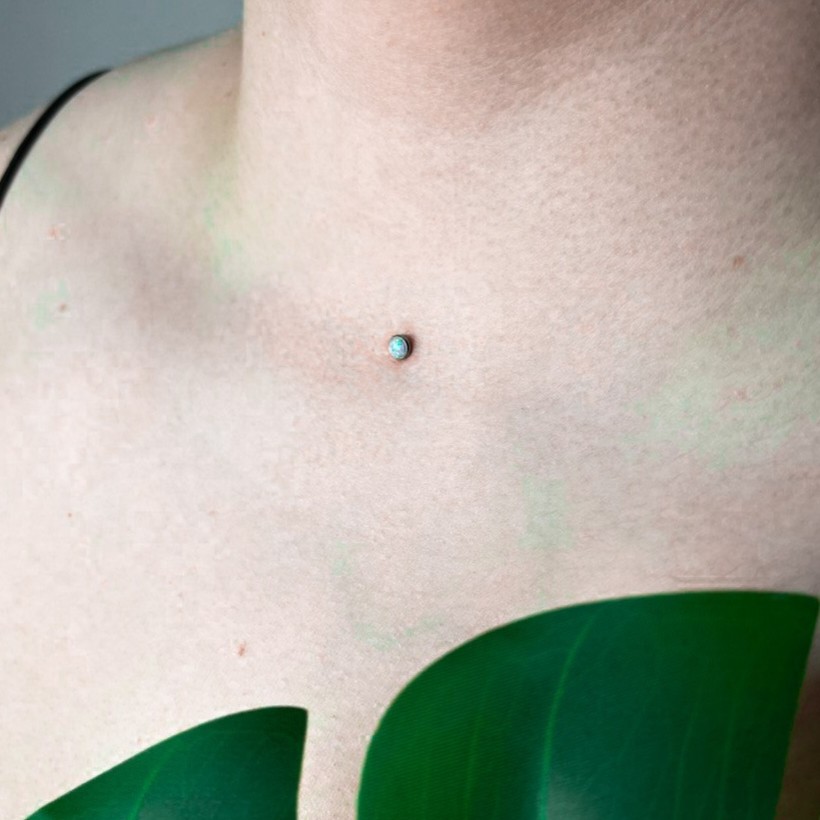 Установка микродермала