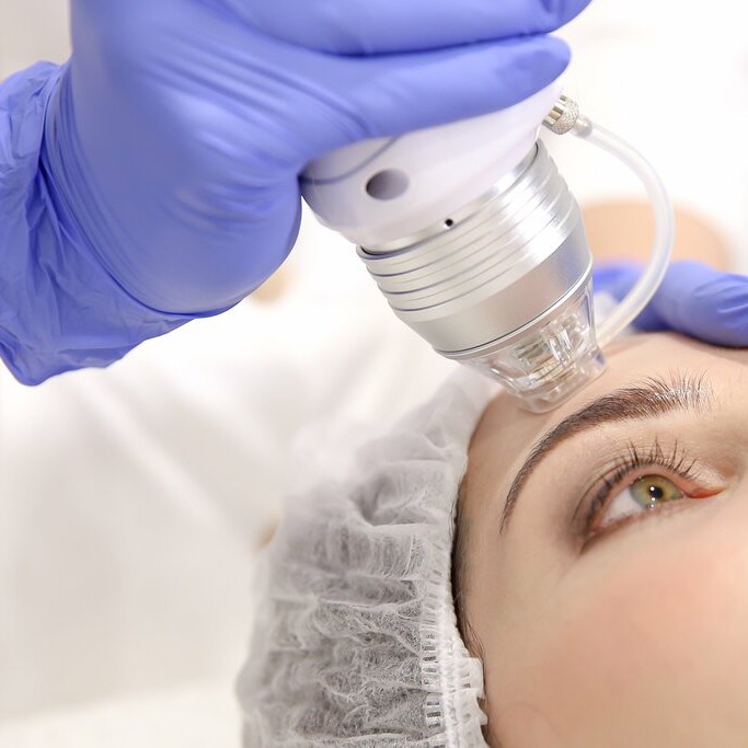 МИКРОИГОЛЬЧАТЫЙ РФ ЛИФТИНГ ЛИЦО+ШЕЯ+ДЕКОЛЬТЕ