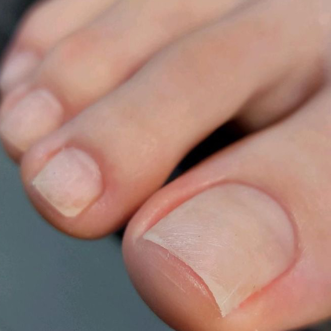 Обработка пальцев без покрытия