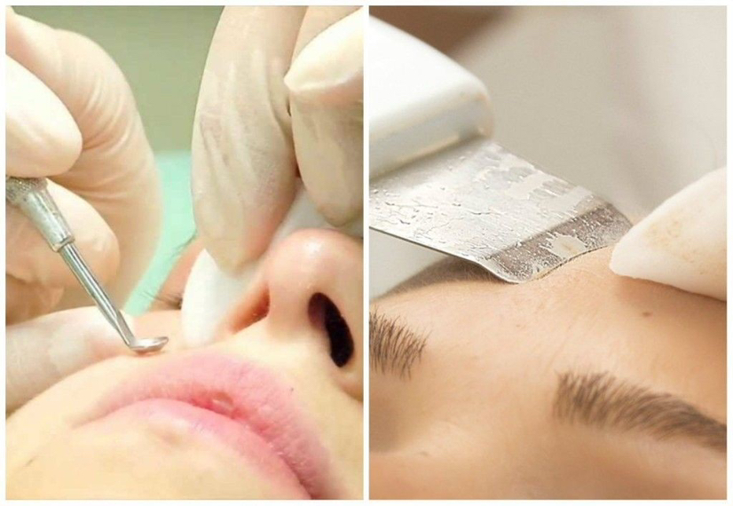 Комбинированная чистка лица