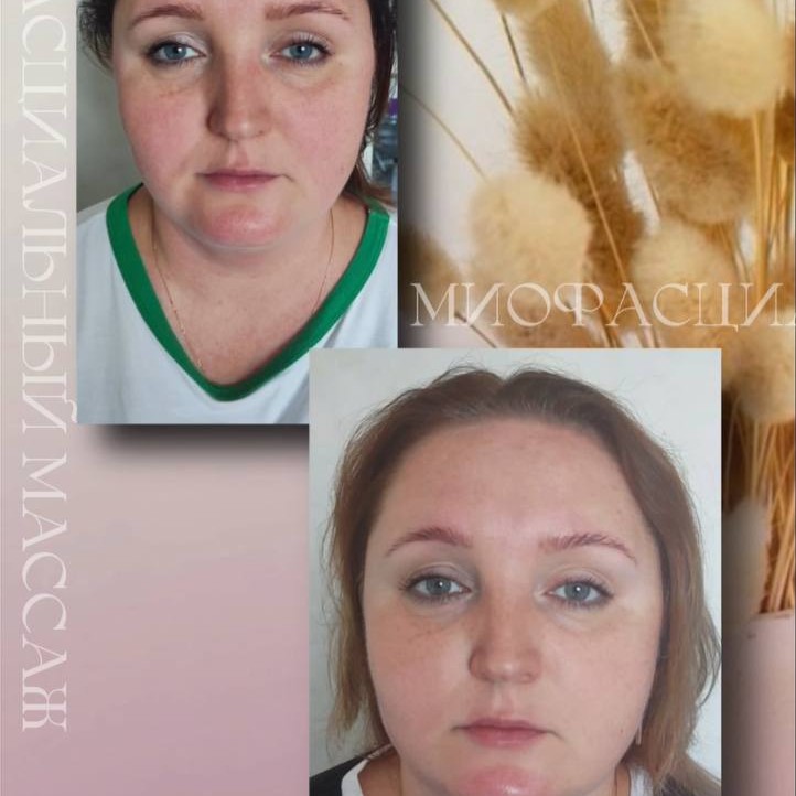 Абонемент на курс массажа лица из 5 процедур  (Скульптурный, миофасциальный, лифтинг -массаж)