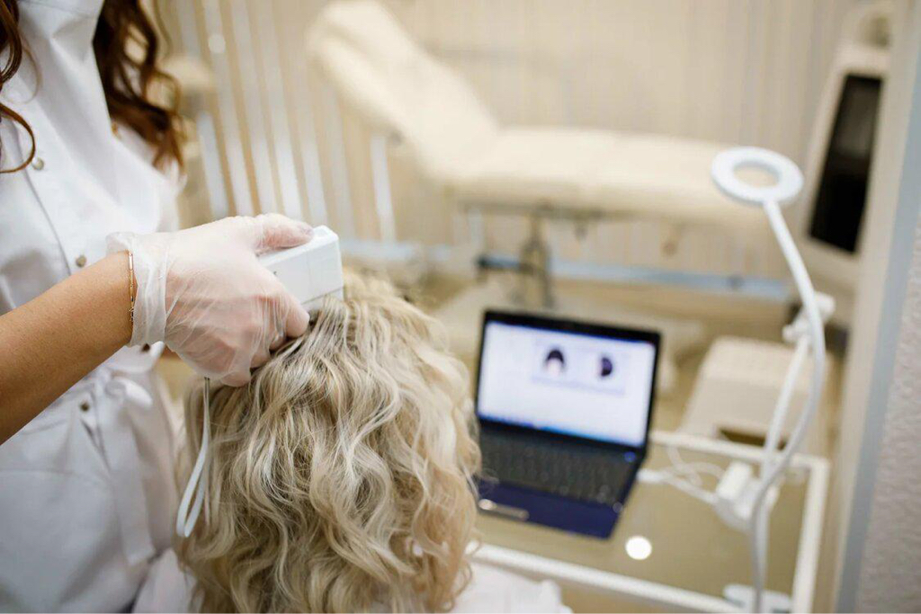 Мезотерапия кожи головы