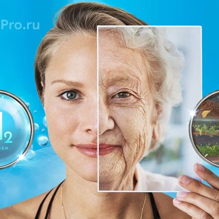 Виталифтинг