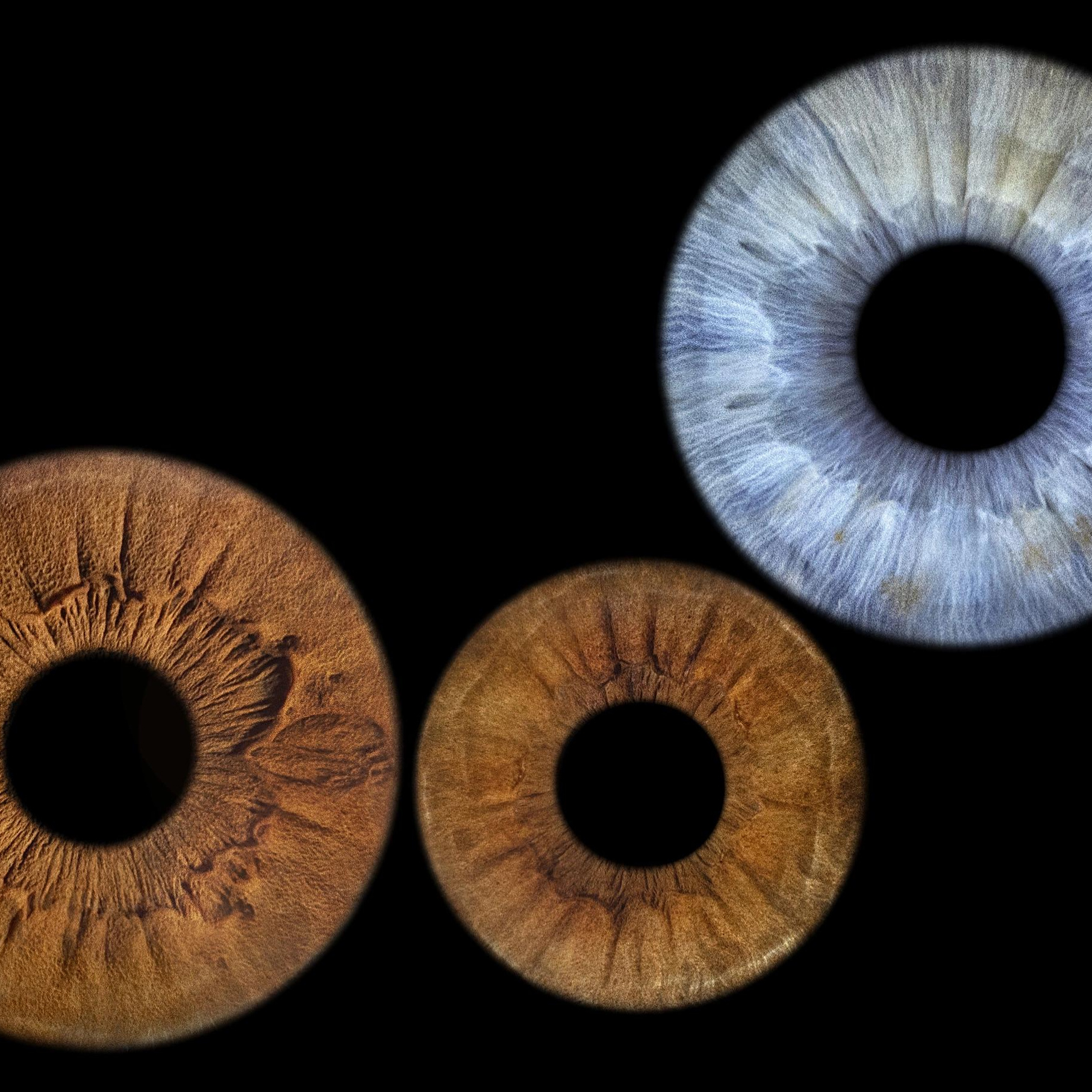 дополнительная радужка