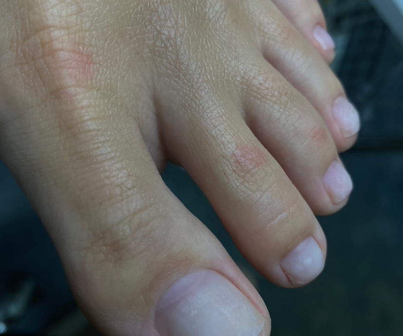 Педикюр только пальчики б/п