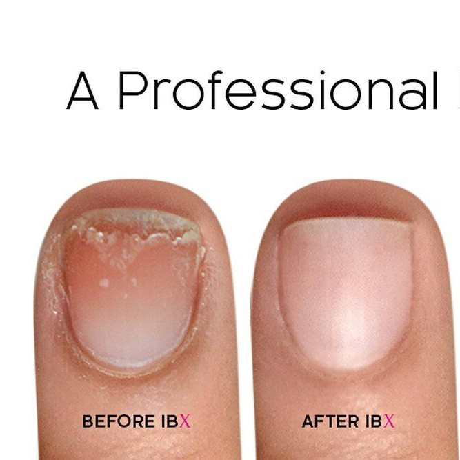 Восстановление ногтей ibx