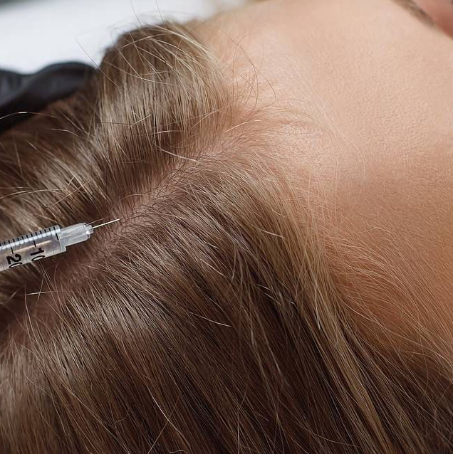 Мезотерапия кожи головы