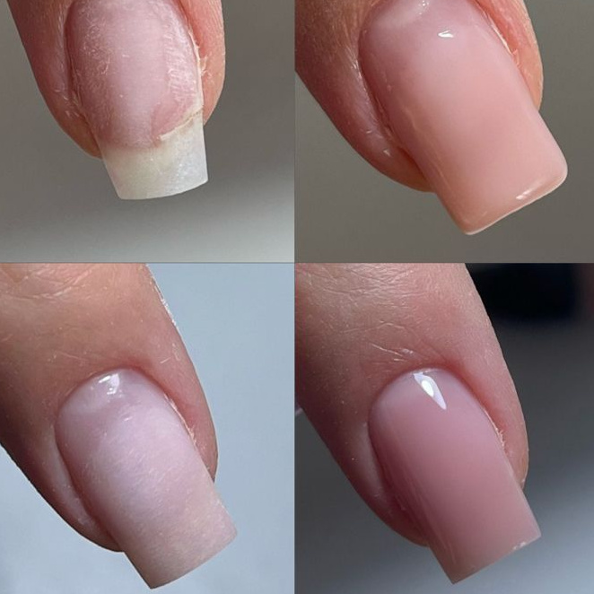 Донаращивание углов (10 пальчиков )