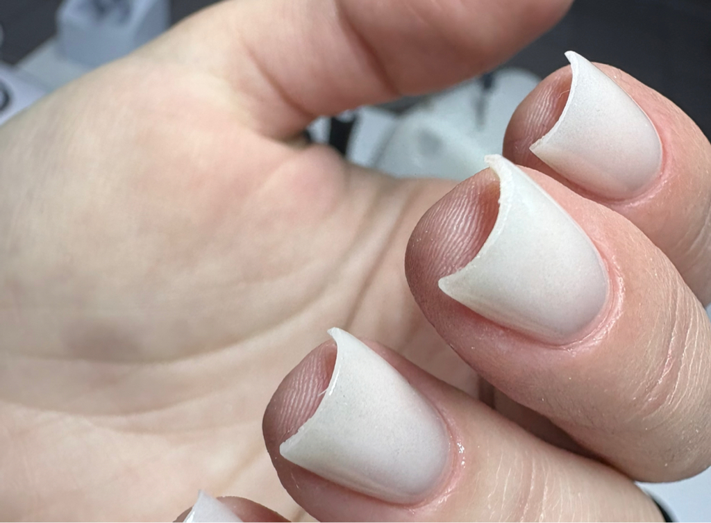 +Восстановление формы жёсткими материалами