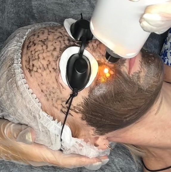 Аппаратная косметология