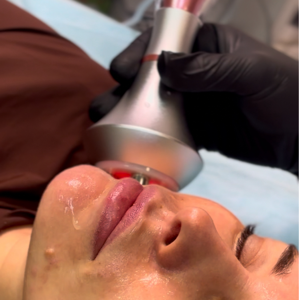 РФ лифтинг для лица