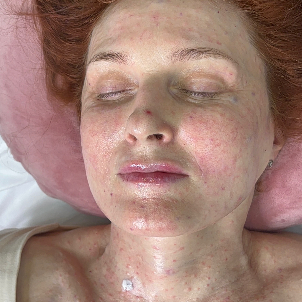 Коллаген Философии лицо,шея,декольте и вокруг глаз 5мл