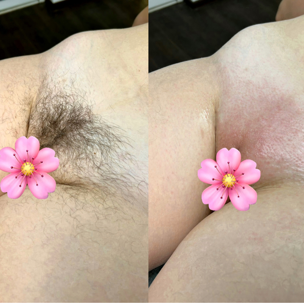 Глубокое бикини