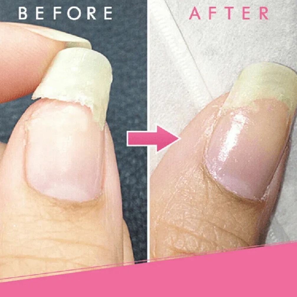 Ремонт трещины на 1 ногте