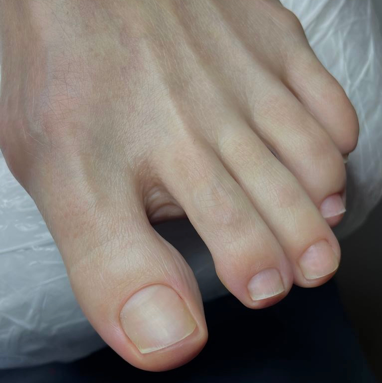 Полный педикюр KART / Golden Trace (без порытия)