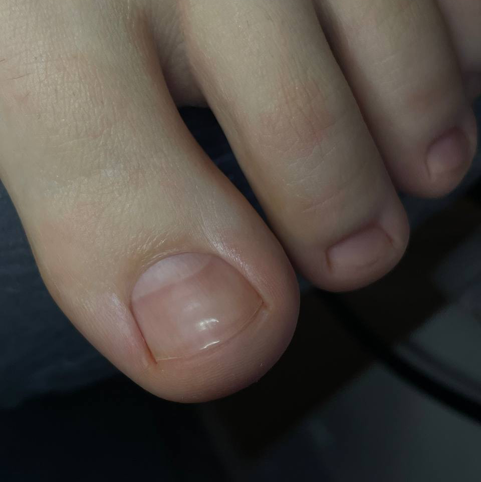 Обработка пальчиков без покрытия