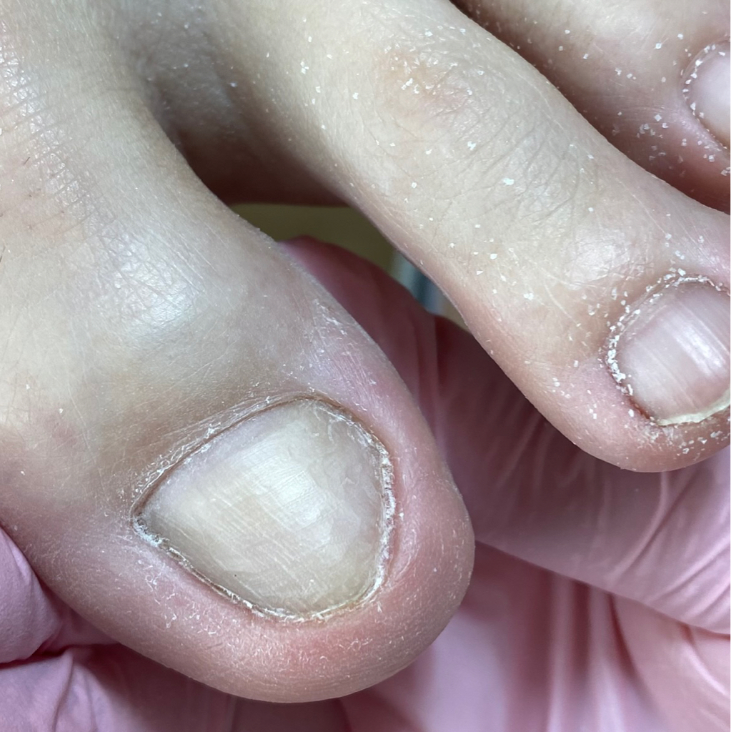 #19 Men's medical pedicure 1,5 hour / Medische pedicure voor mannen 1,5 uur