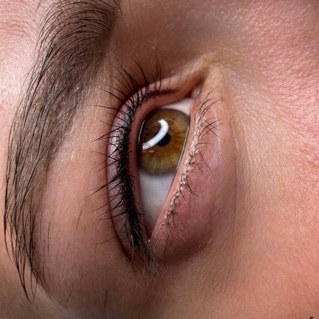 Перманент Межреснички